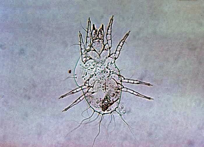 Microscopic view of Trombicula chigger mite larva